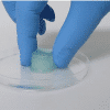 PosiSep X resorbable nasal spacer