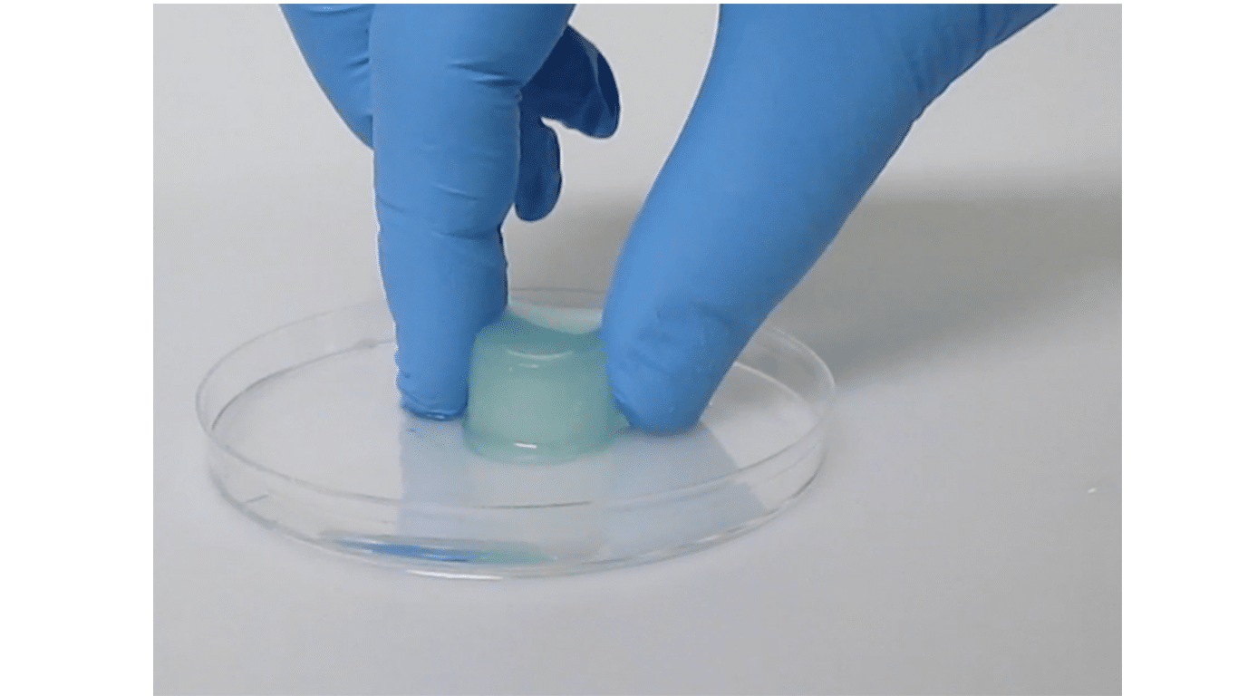 PosiSep X resorbable nasal spacer