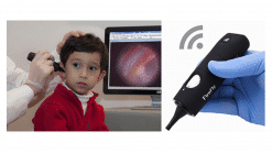 Wireless Video Otoscope