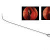 Vectra F Drug Delivery Microsponge